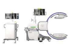 什么是移動式三維C形臂?它的臨床優勢體現在哪?