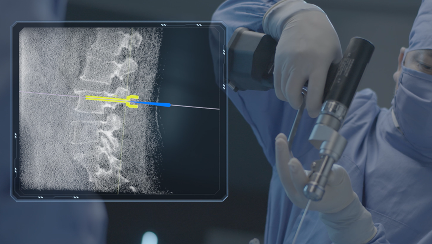 機器人做手術好還是醫生做手術好,機器人做手術有哪些好處?