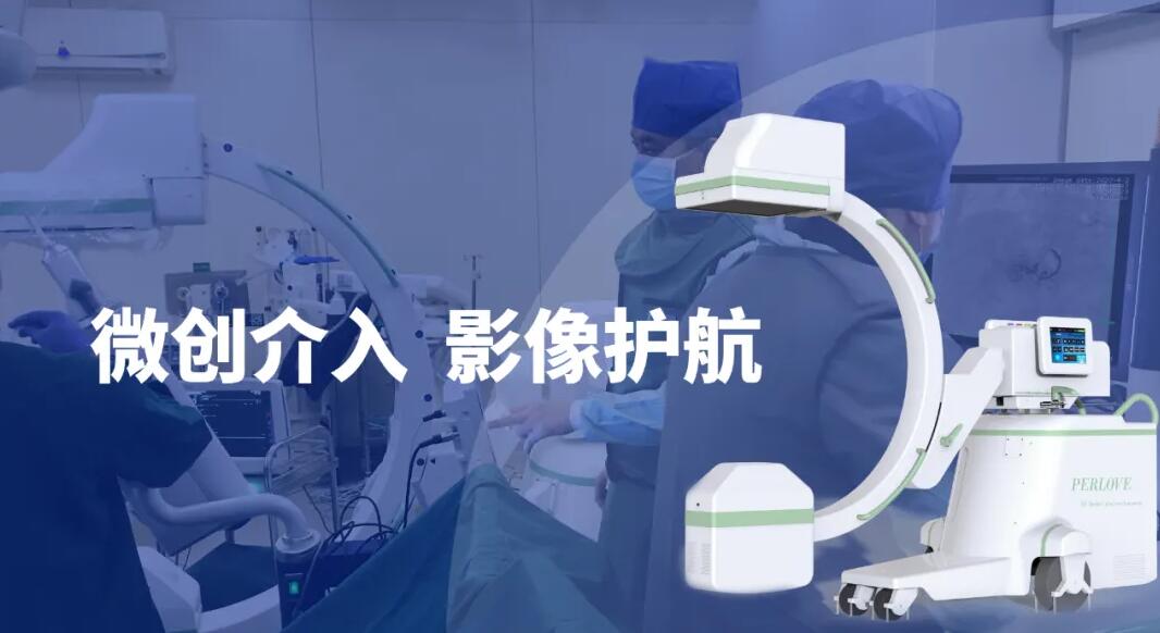 高清影像介入c臂機助力微創介入手術更成功 高清影像介入c臂機助力微創介入手術更成功