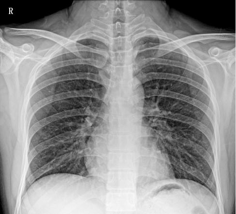 臨床圖像 臨床圖像