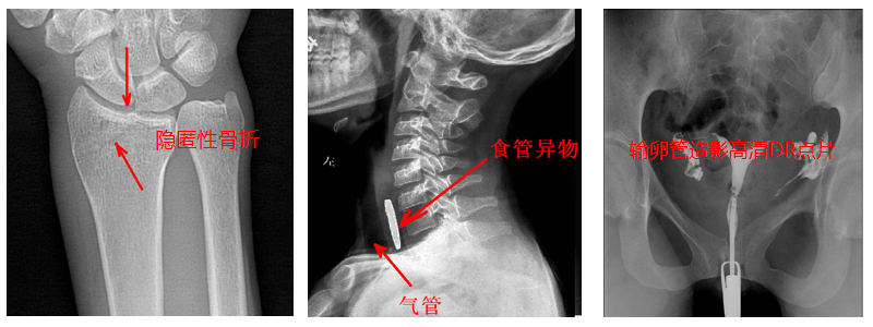 動態DR機準確點片 動態DR機準確點片