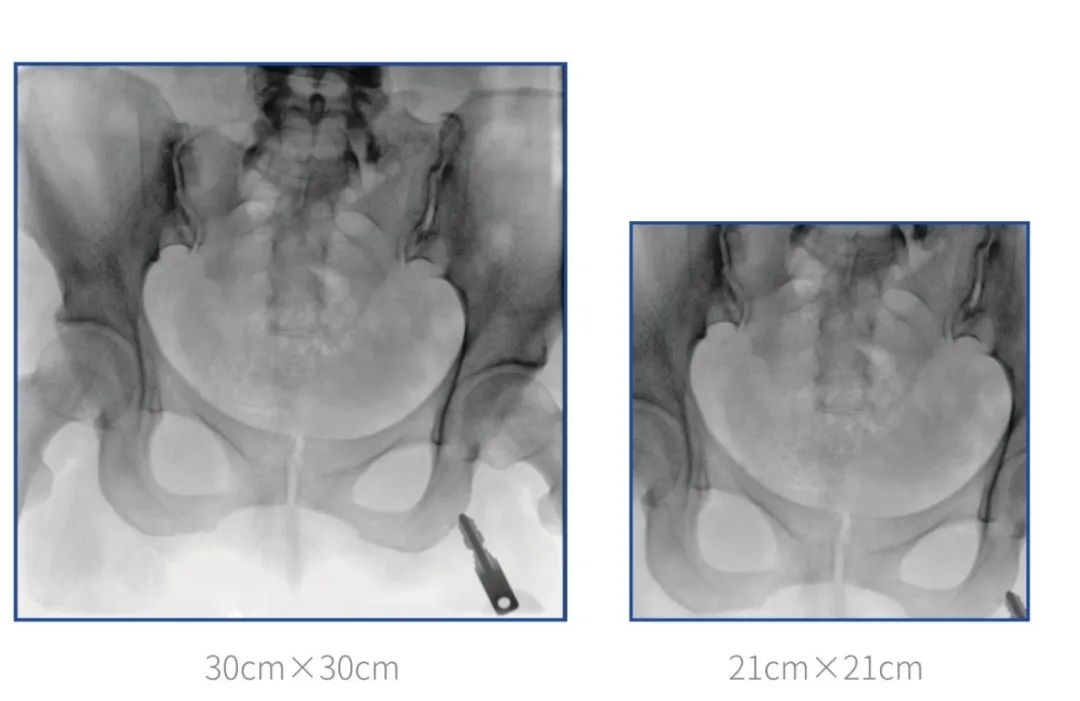 大尺寸平板C形臂 大尺寸平板C形臂