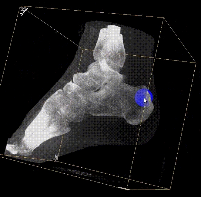 【醫(yī)療科普】：三維影像提高手術的精度