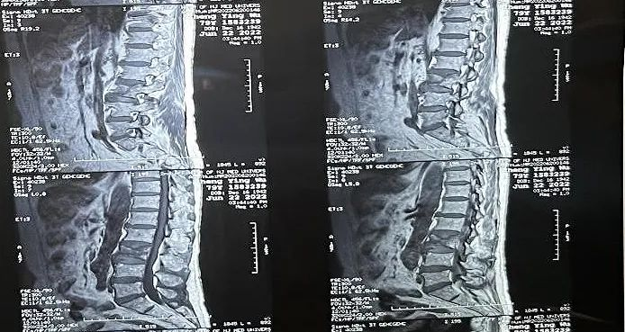 大平板C臂機-術前影像 大平板C臂機-術前影像