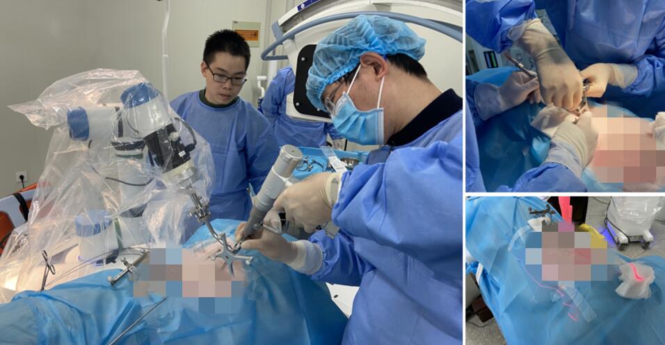 脊柱微創手術機器人-手術微創化 脊柱微創手術機器人-手術微創化