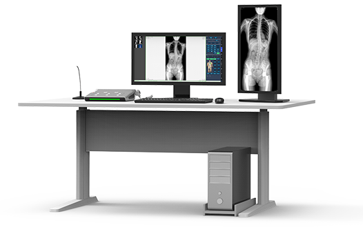 大視野平板動態DR全脊柱一次成像 大視野平板動態DR全脊柱一次成像