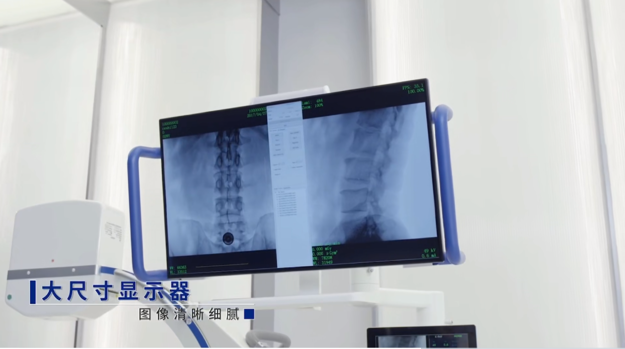 一體式移動C形臂大尺寸顯示器 一體式移動C形臂大尺寸顯示器