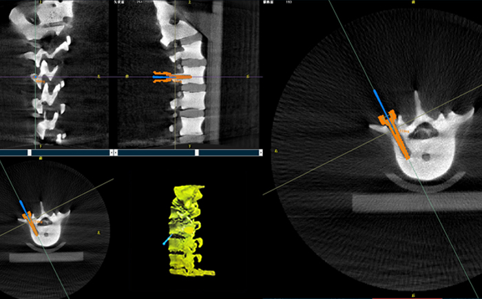 機器人手術系統3D影像 機器人手術系統3D影像