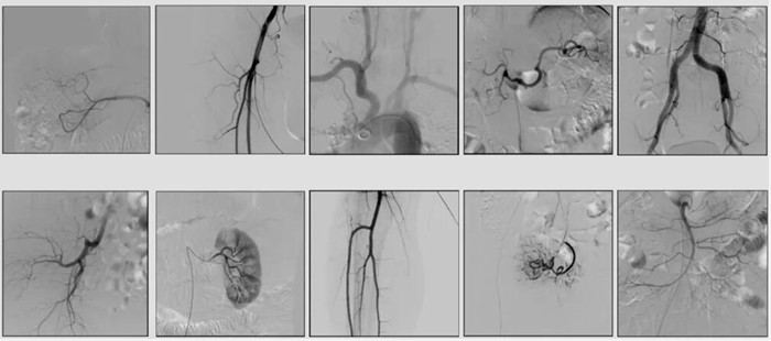 中C臨床影像 中C臨床影像