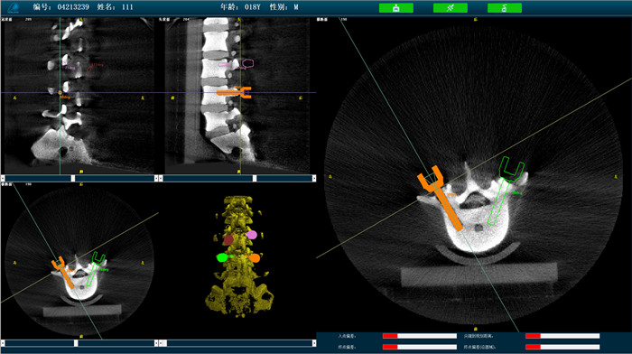 機器人手術系統3D影像 機器人手術系統3D影像
