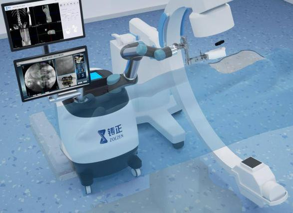 盤點幾款骨科手術(shù)機器人品牌 盤點幾款骨科手術(shù)機器人品牌