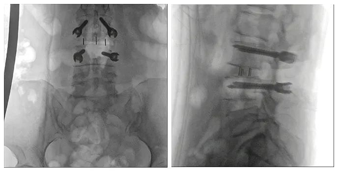 術中三維導航C臂影像 術中三維導航C臂影像