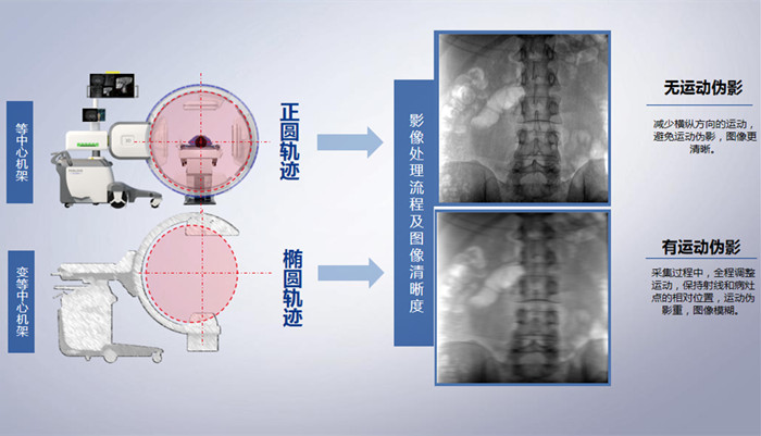 三維C臂的機架設計 三維C臂的機架設計