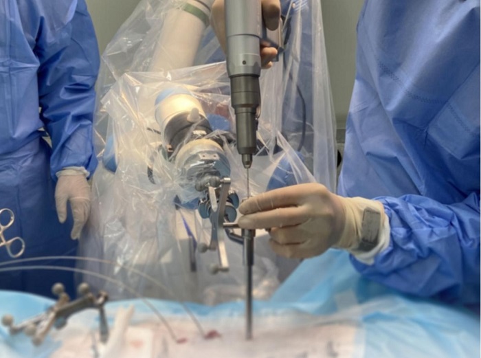 脊柱外科手術(shù)導(dǎo)航定位系統(tǒng)