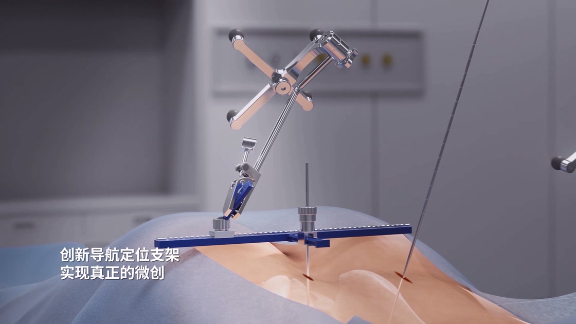 骨科手術機器人導航定位支架